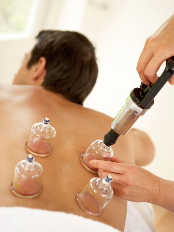 cupping therapy near me prices