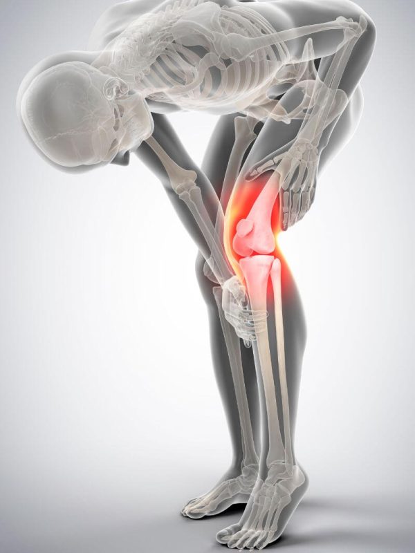 knee pain physiotherapy at home